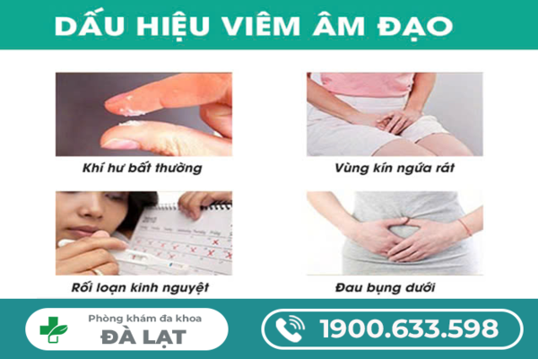 Hình ảnh minh họa